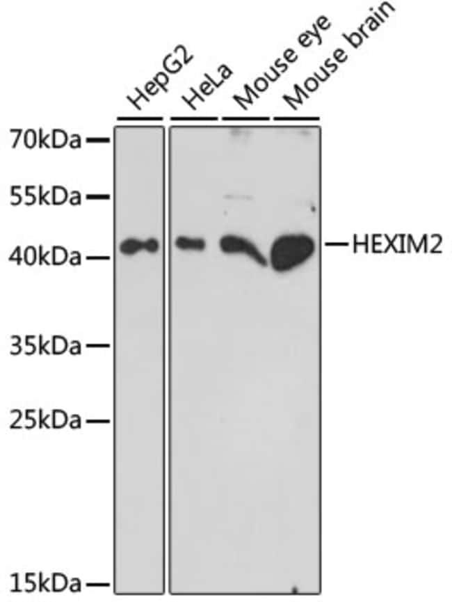 100UL HEXIM2 ANTIBODY 100 ul