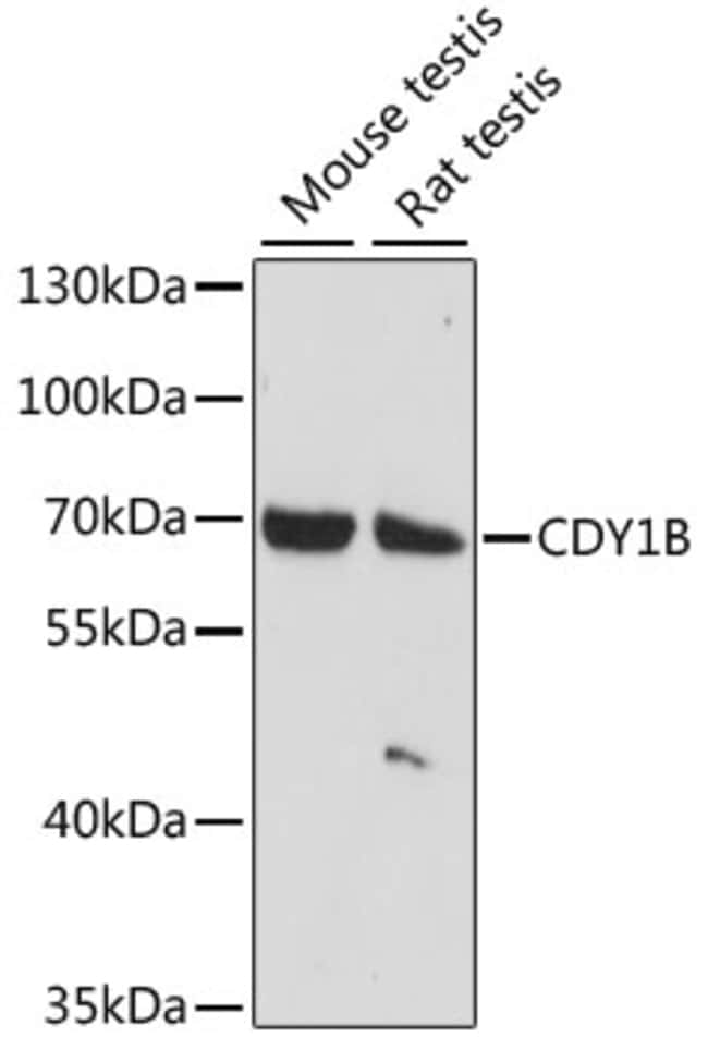 100UL CDY1B ANTIBODY 100 ul