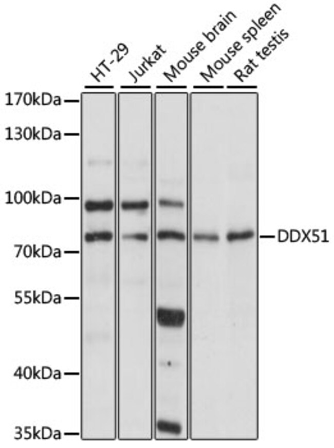 100UL DDX51 ANTIBODY 100 ul