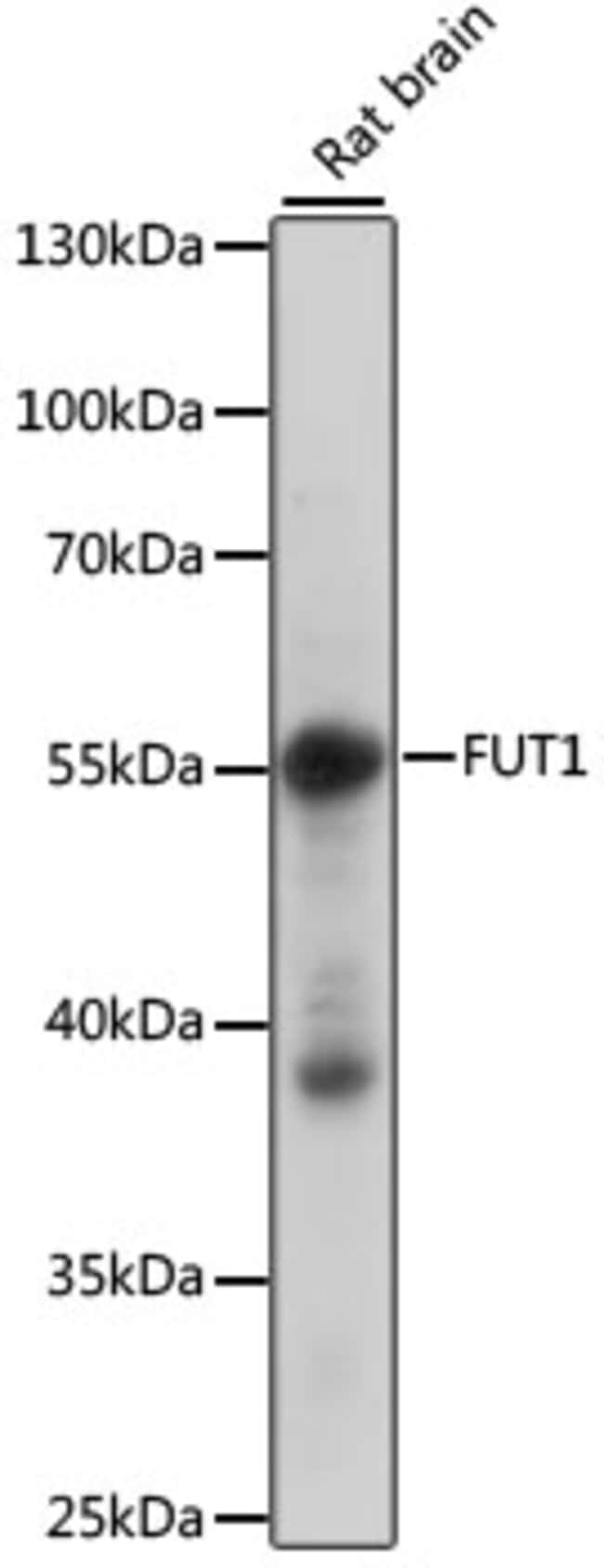 100UL FUT1 ANTIBODY 100 ul