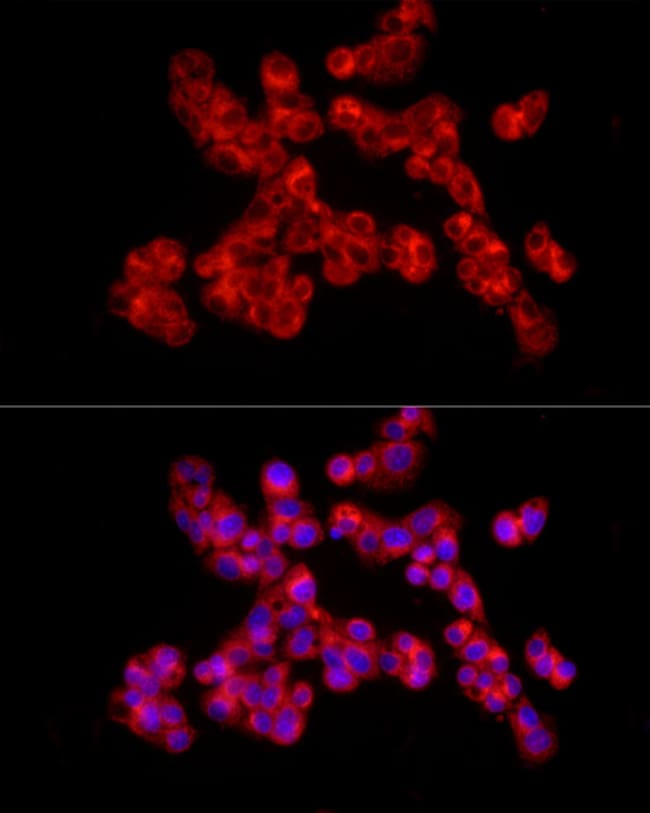 100UL COLLAGEN II ANTIBODY 100 ul
