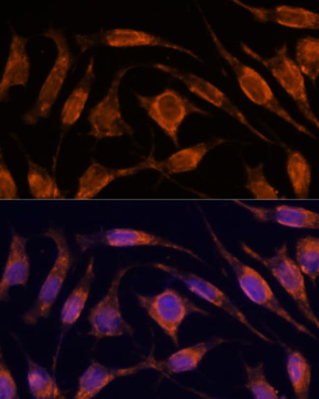 100UL IMPORTIN 4 ANTIBODY 100 ul