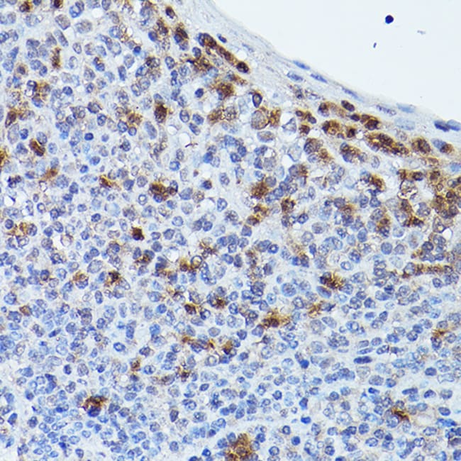 100UL GPR109 ANTIBODY 100 ul