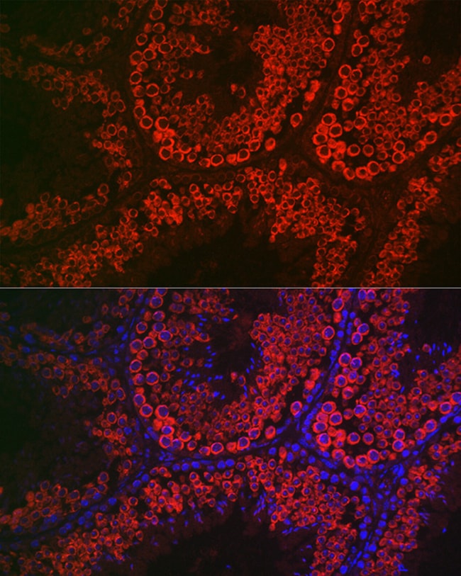 100UL DDX4 ANTIBODY 100 ul
