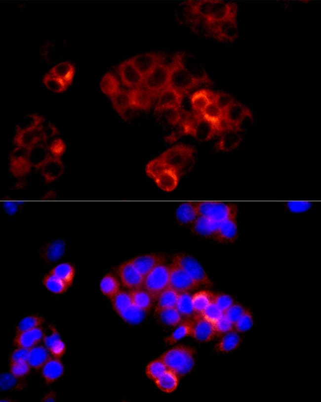 100UL ANGIOTENSIN ANTIBODY 100 ul