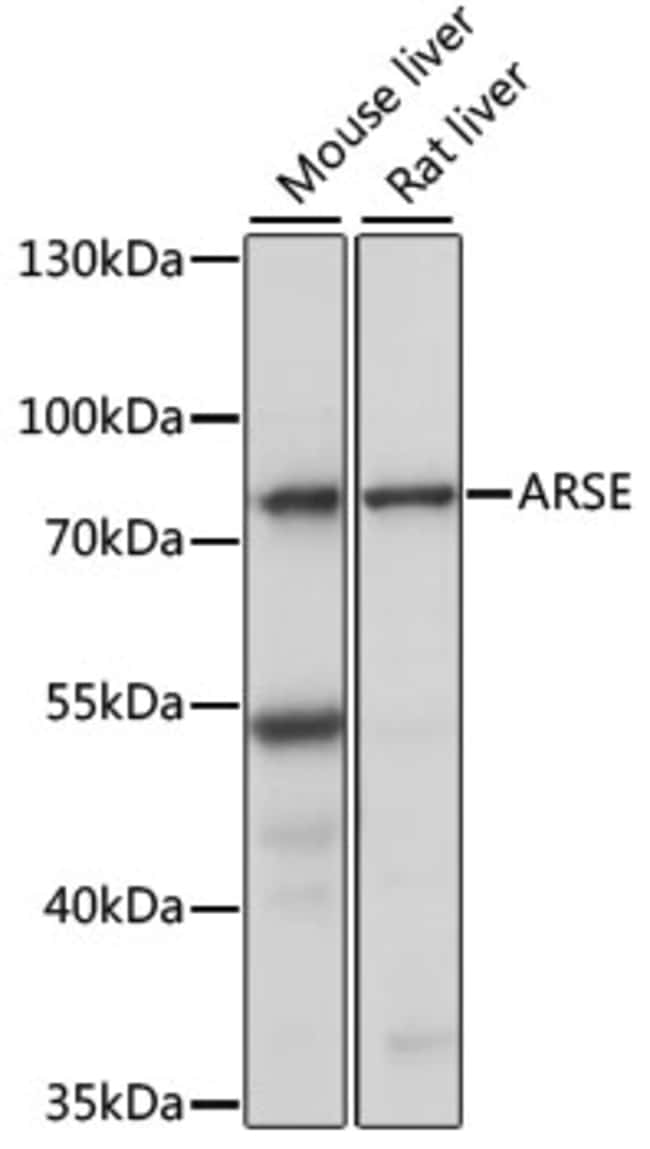 100UL ARYLSULFATASE E ANTIBODY 100 ul