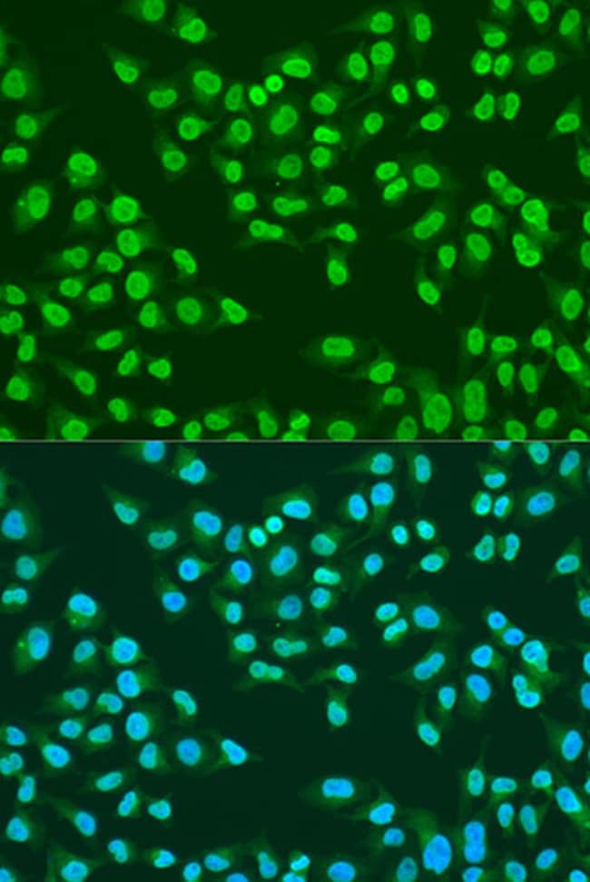 100UL ATM ANTIBODY 100 ul