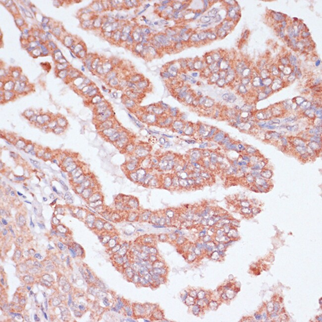 100UL CDC20 ANTIBODY 100 ul