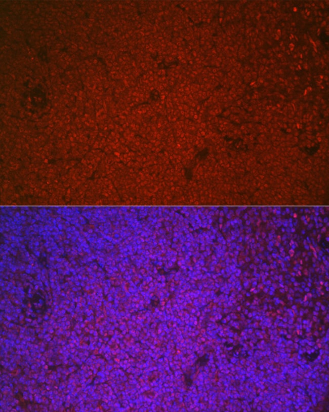 100UL ETS1 ANTIBODY 100 ul
