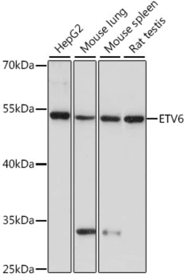 100UL ETV6 ANTIBODY 100 ul
