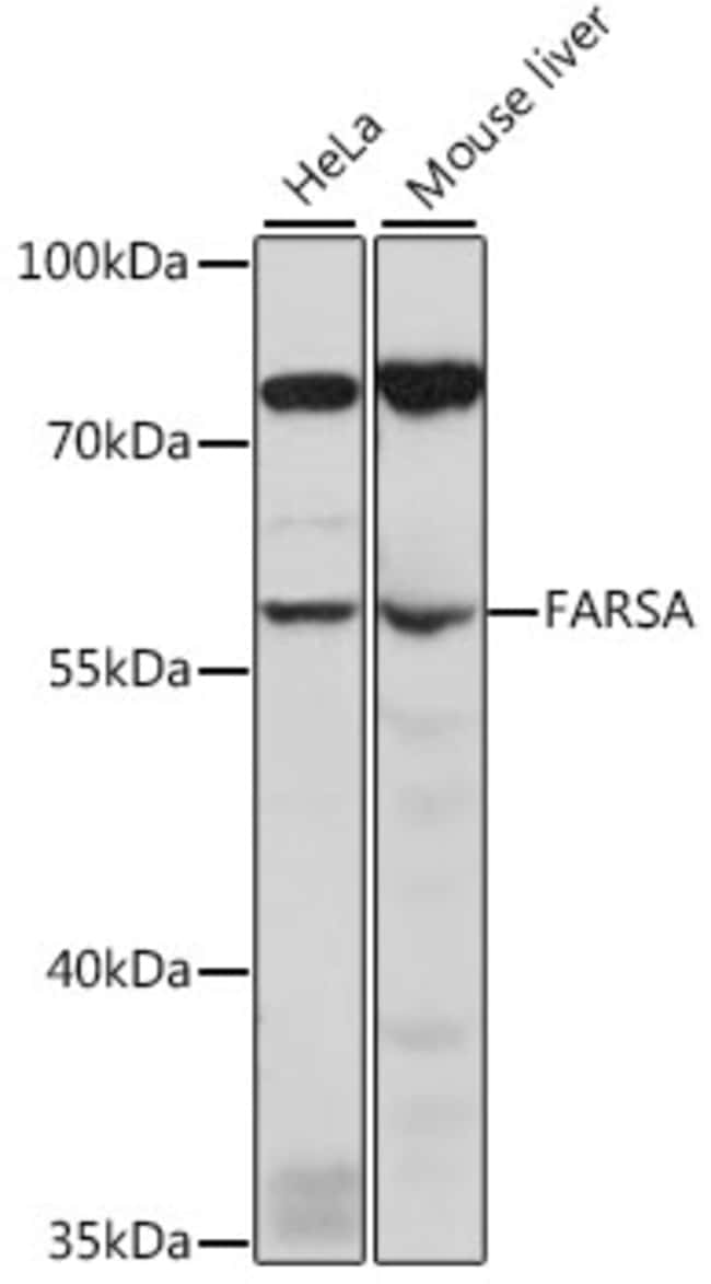 100UL FARSA ANTIBODY 100 ul