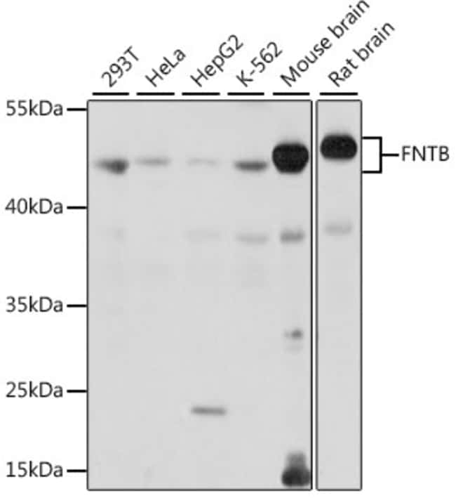 100UL FNTB ANTIBODY 100 ul