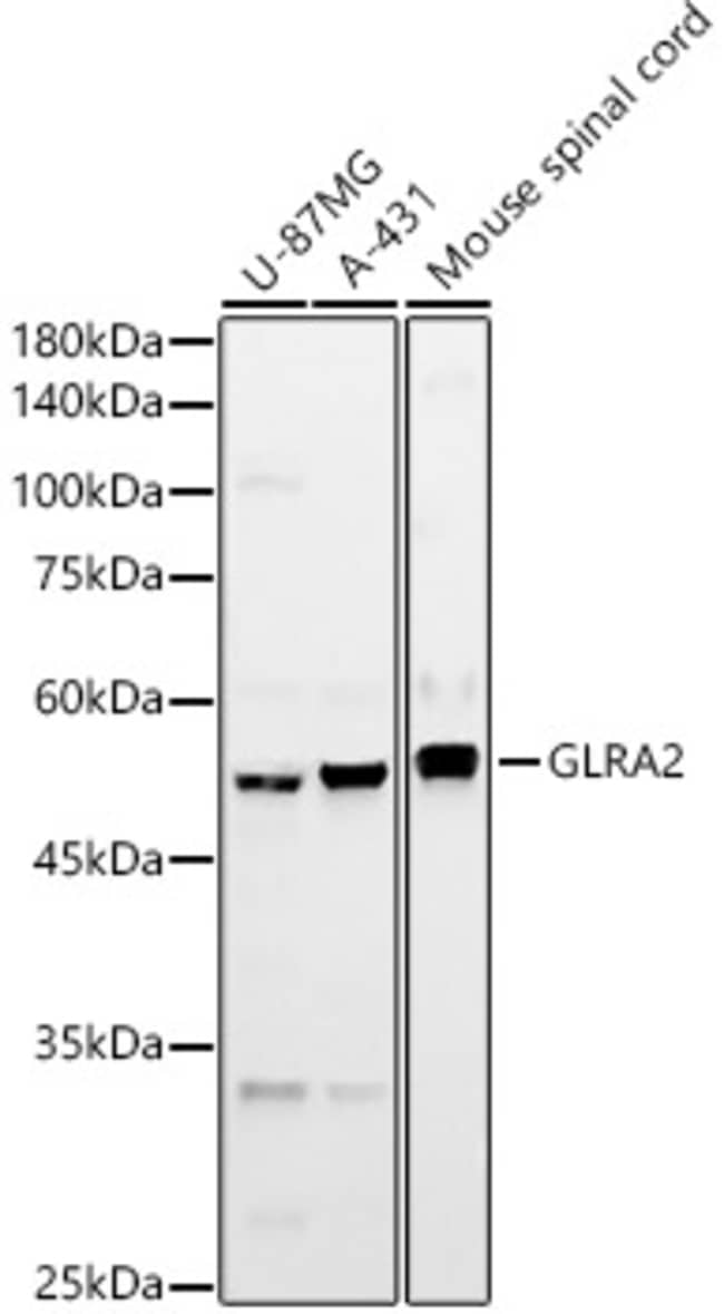 100UL GLRA2 ANTIBODY 100 ul