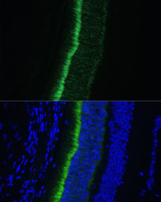 100UL GNGT1 ANTIBODY 100 ul