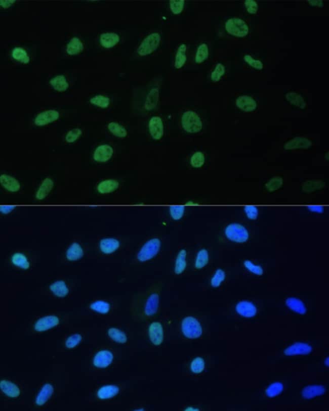 100UL HNRNP D ANTIBODY 100 ul