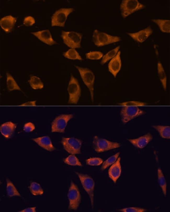 100UL IL10RB ANTIBODY 100 ul