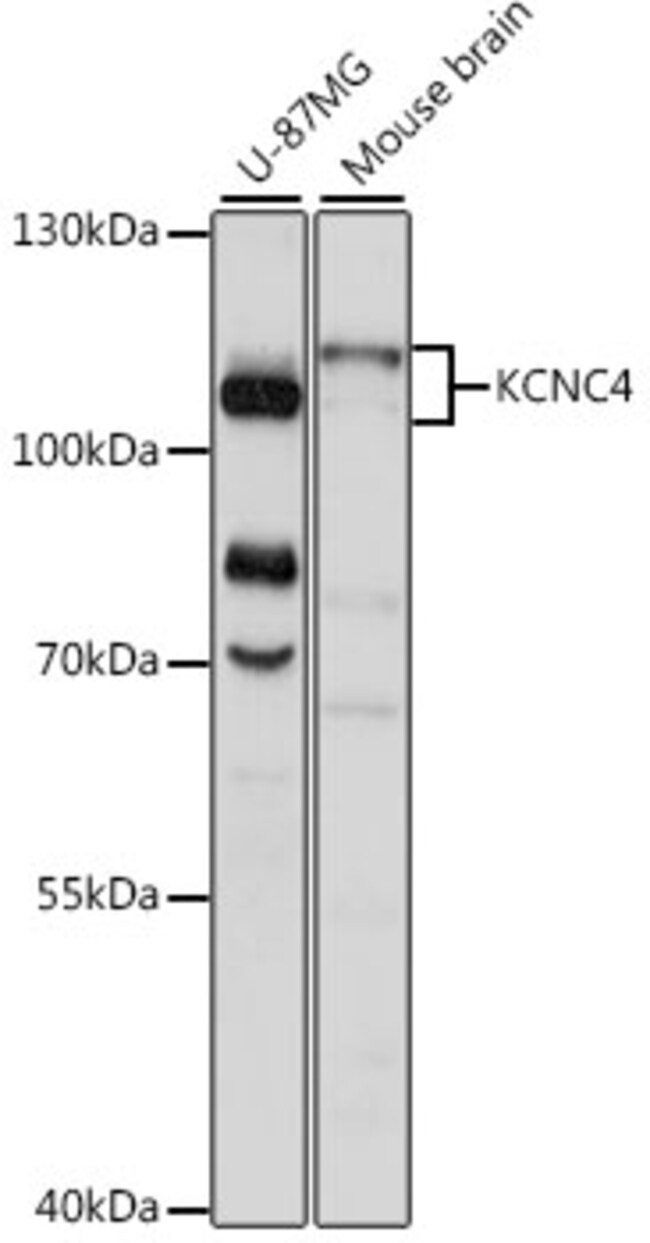 100UL KV3.4 (KCNC4) ANTIBODY 100 ul