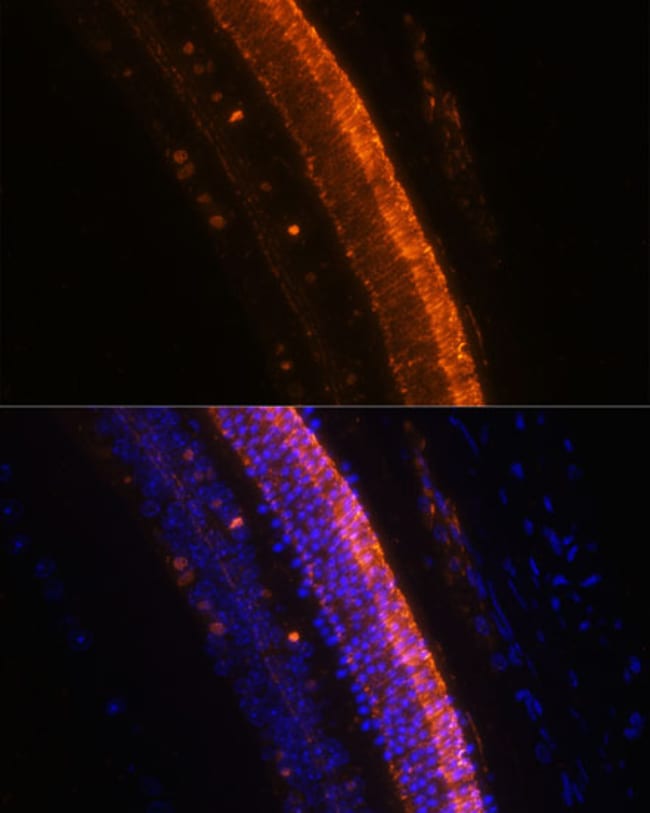 100UL KCNS2 ANTIBODY 100 ul