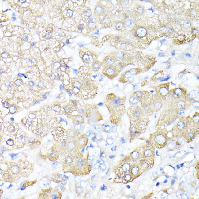 100UL HAPTOGLOBIN ANTIBODY 100 ul