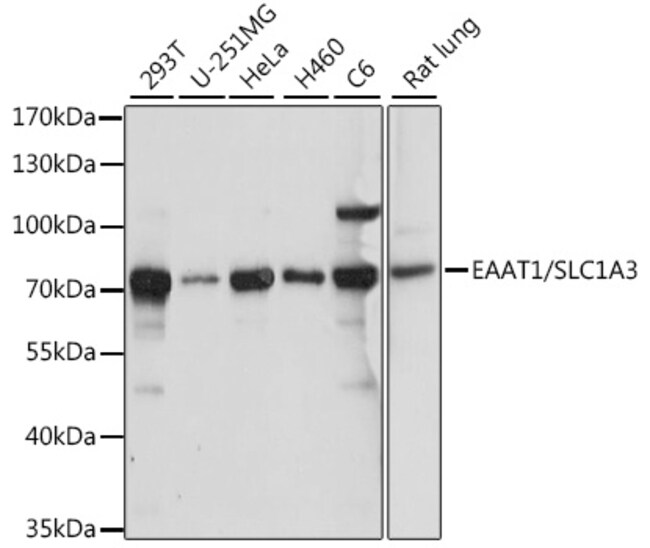 100UL GLAST ANTIBODY 100 ul