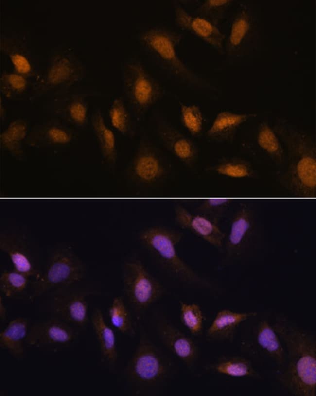 100UL HCC1 ANTIBODY 100 ul