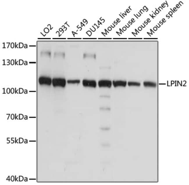 100UL LPIN2 ANTIBODY 100 ul