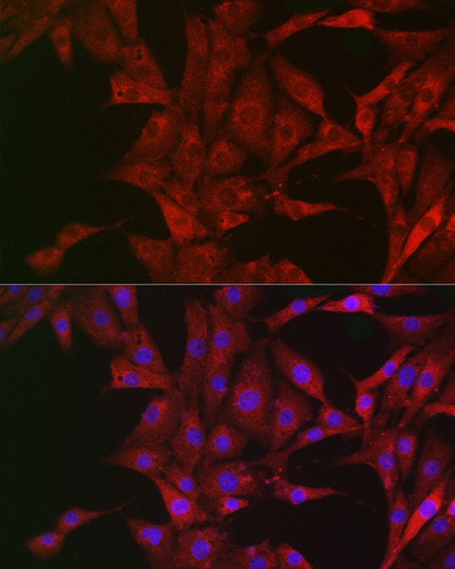 100UL BIM ANTIBODY 100 ul