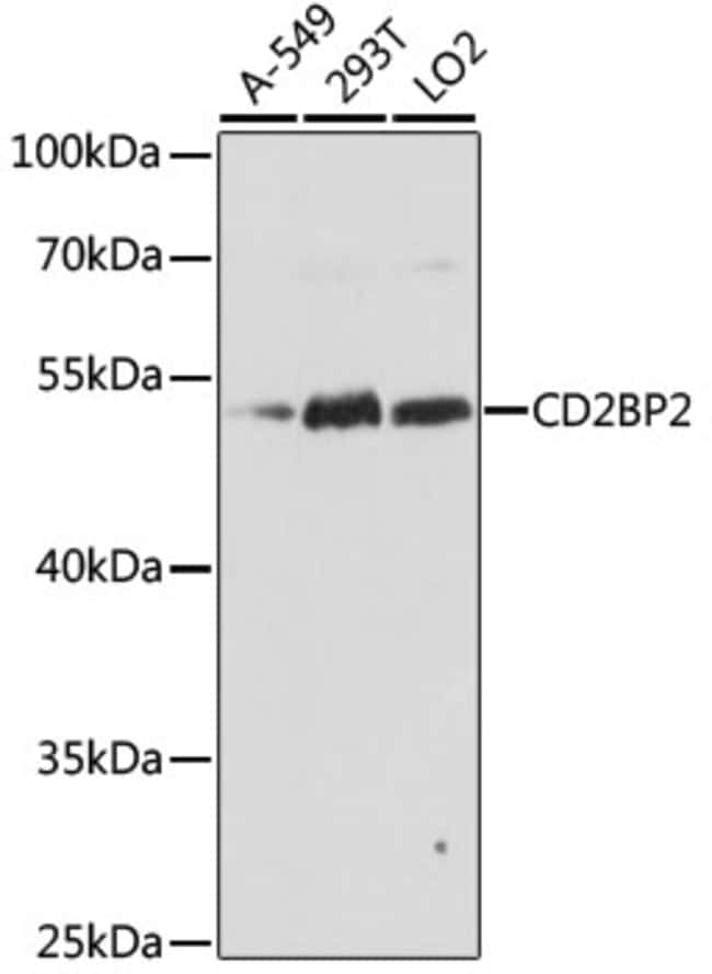 100UL CD2BP2 ANTIBODY 100 ul