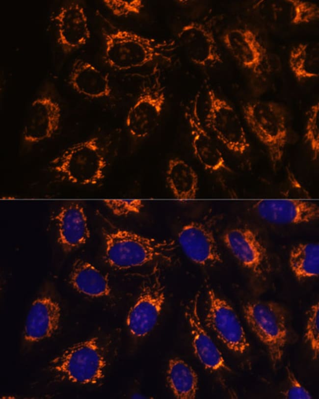 100UL ACAA2 ANTIBODY 100 ul