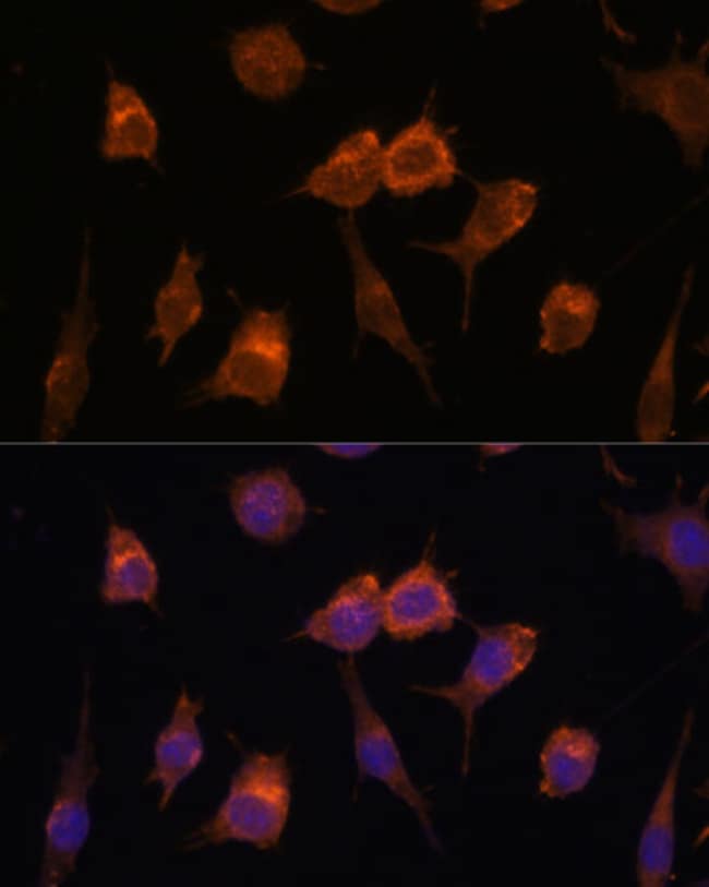 100UL AVIL ANTIBODY 100 ul