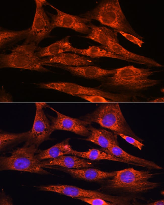 100UL FSTL1 ANTIBODY 100 ul