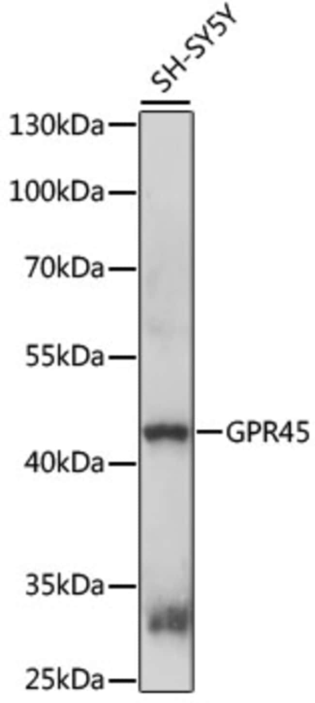 100UL GPR45 ANTIBODY 100 ul