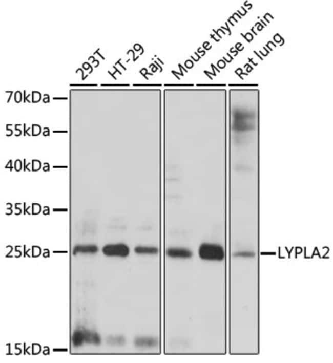 100UL LYPLA2 ANTIBODY 100 ul