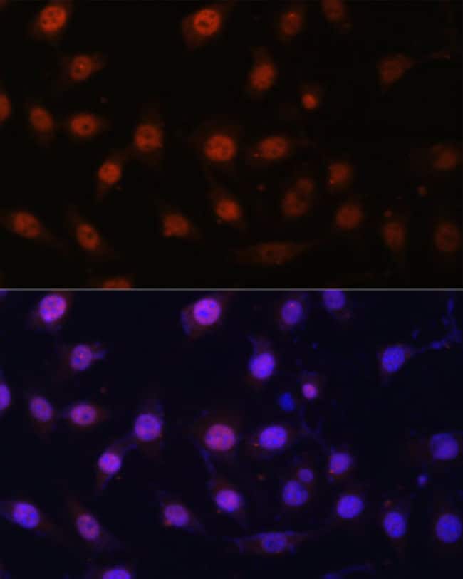 100UL LSD1 ANTIBODY 100 ul