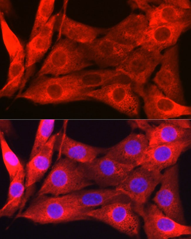 100UL GALECTIN 1 ANTIBODY 100 ul