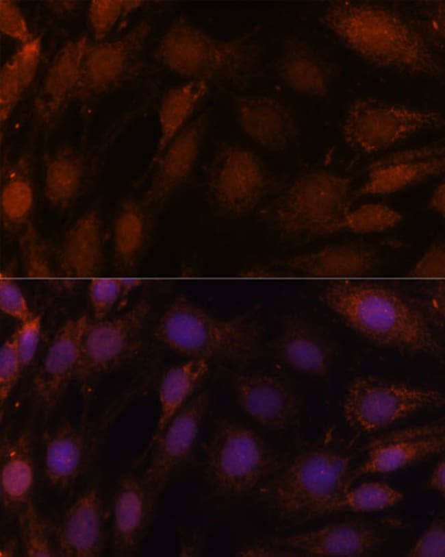 100UL GCAT ANTIBODY 100 ul