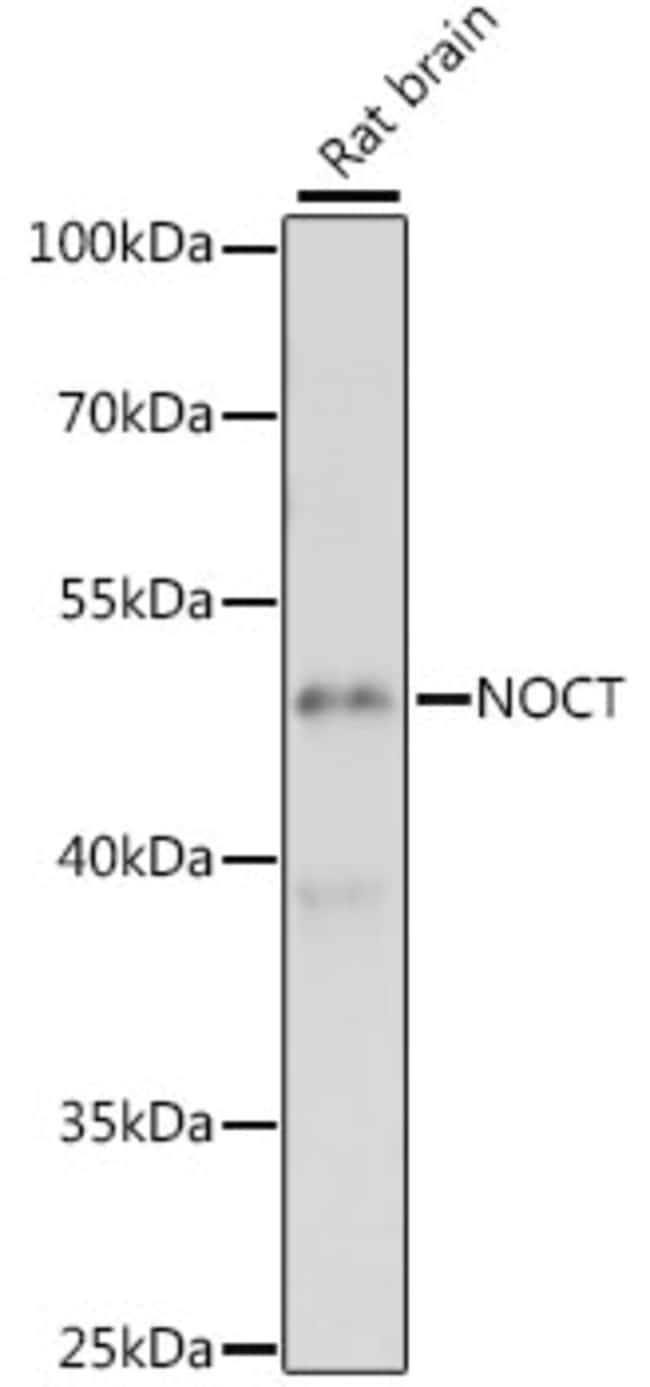 100UL CCRN4L ANTIBODY 100 ul
