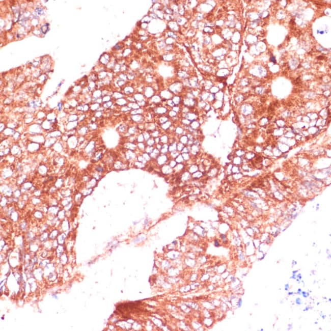 100UL FAM98A ANTIBODY 100 ul