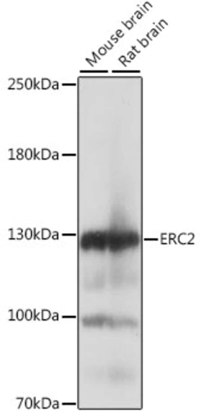 100UL ERC2 ANTIBODY 100 ul