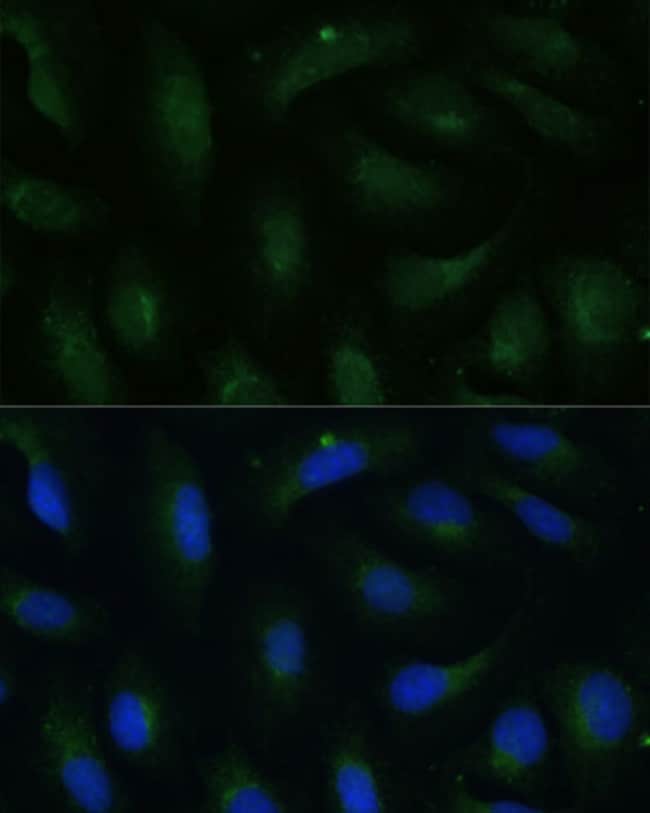 100UL COPG2 ANTIBODY 100 ul