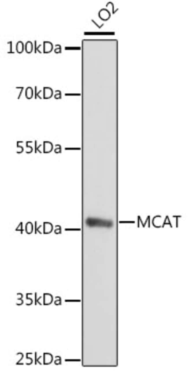 100UL MCAT ANTIBODY 100 ul
