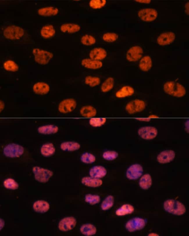 100UL MYEF2 ANTIBODY 100 ul