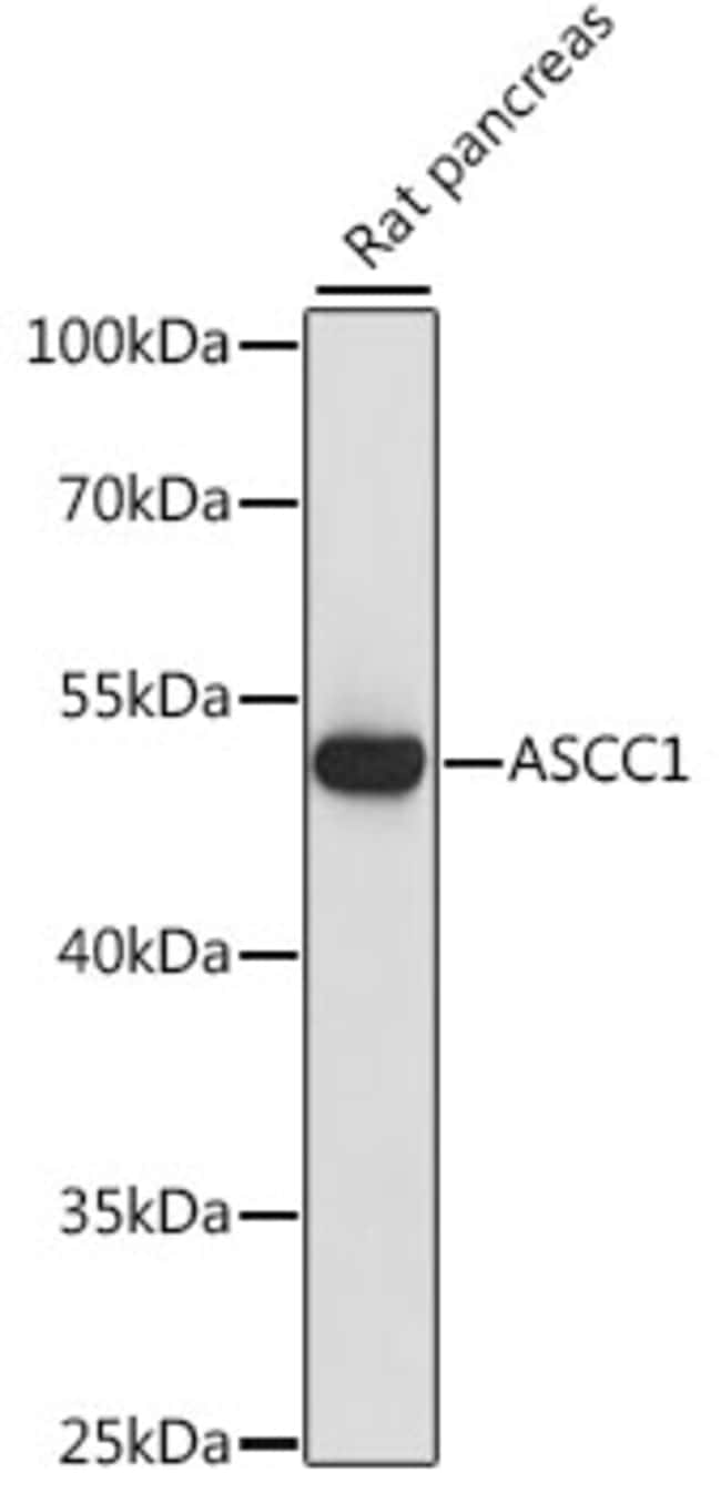100UL ASCC1 ANTIBODY 100 ul