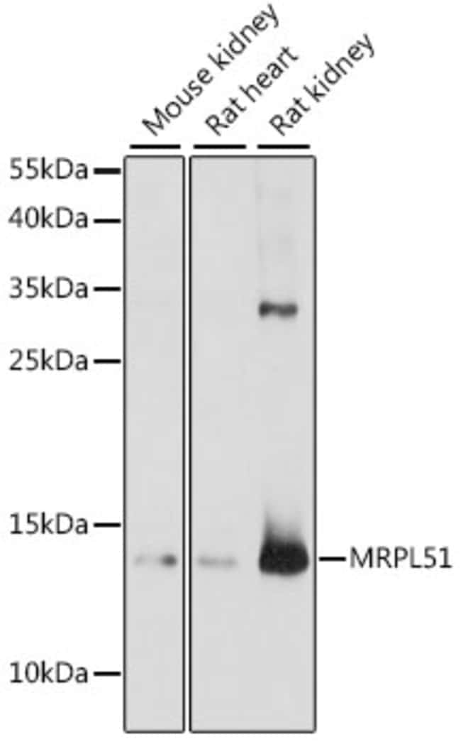100UL MRPL51 ANTIBODY 100 ul