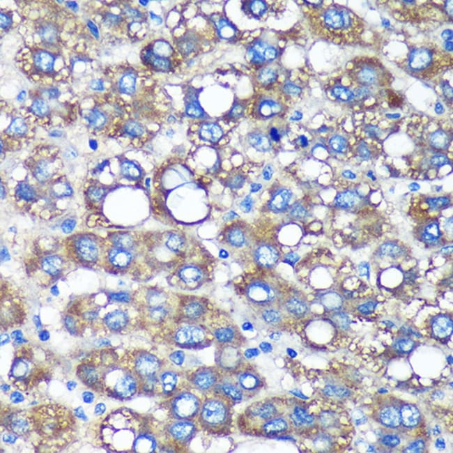 100UL C3ORF1 ANTIBODY 100 ul
