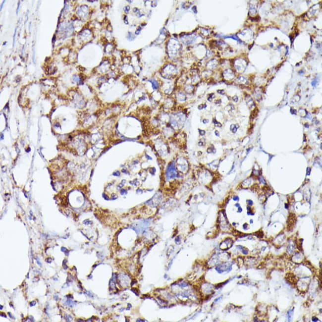 100UL CDK5RAP1 ANTIBODY 100 ul