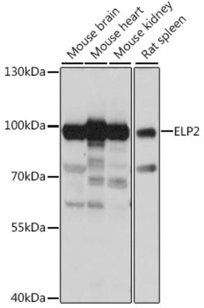 100UL ELP2 ANTIBODY 100 ul