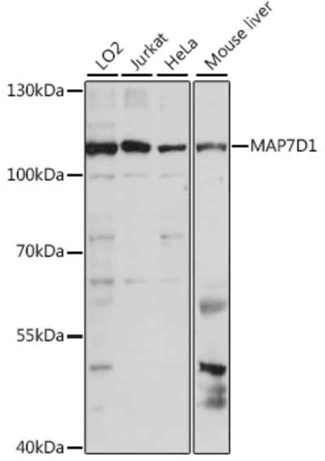 100UL MAP7D1 ANTIBODY 100 ul