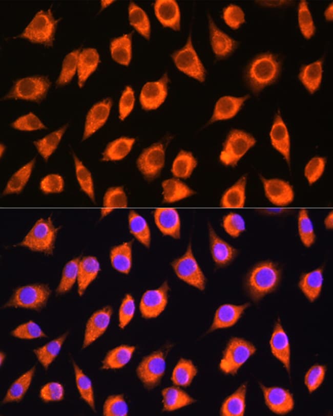 100UL LMBRD1 ANTIBODY 100 ul