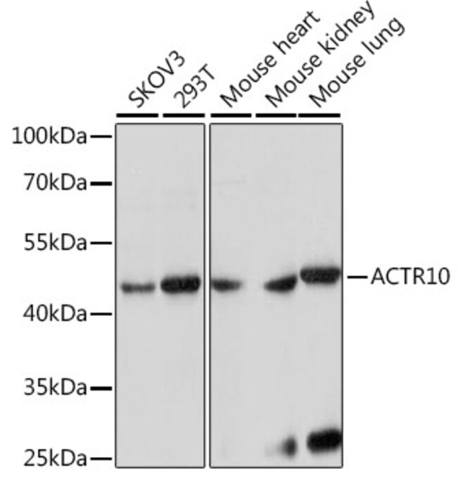 100UL ACTR10 ANTIBODY 100 ul